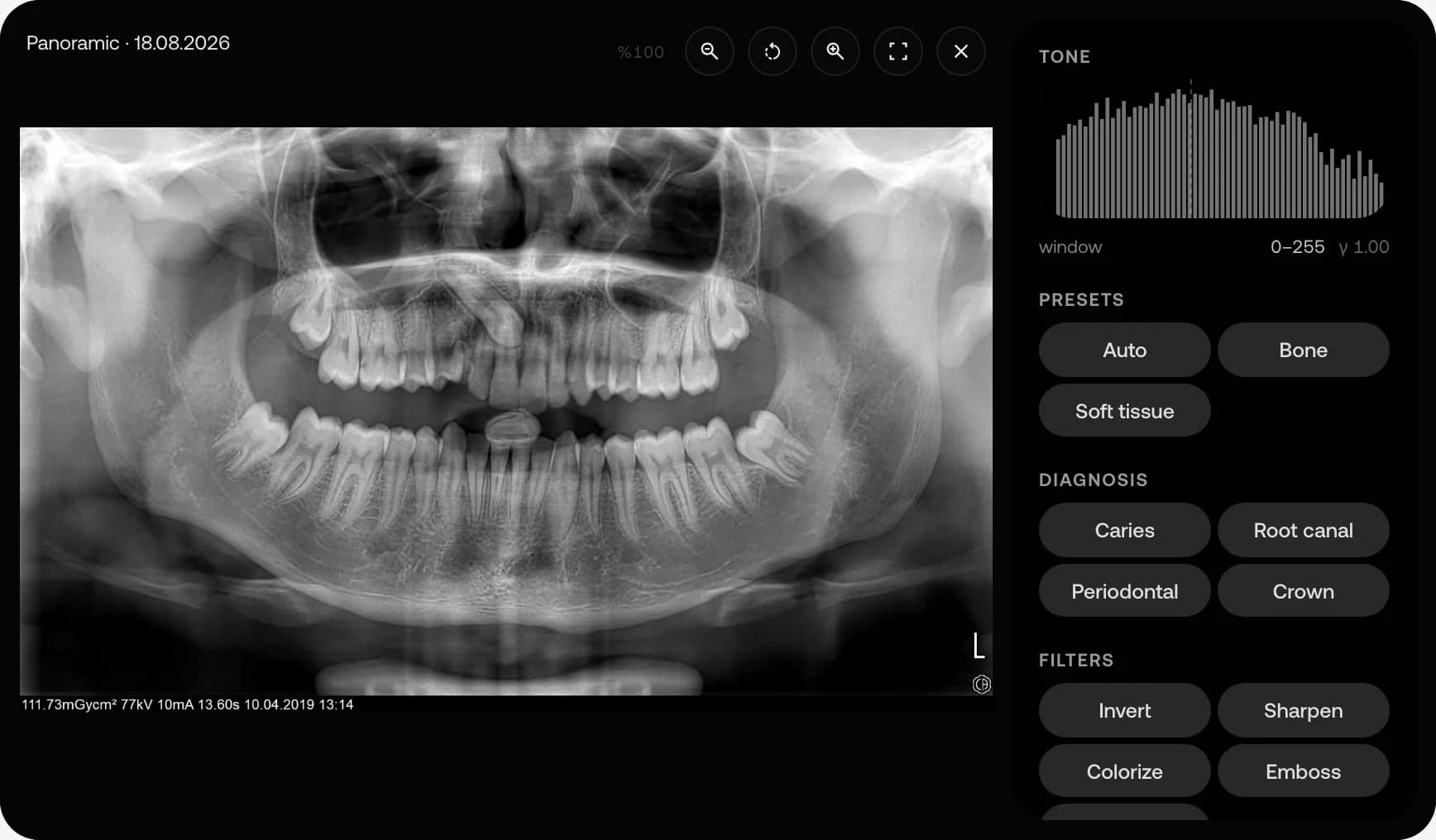 A sample dental panoramic image in the MyKlinik viewer