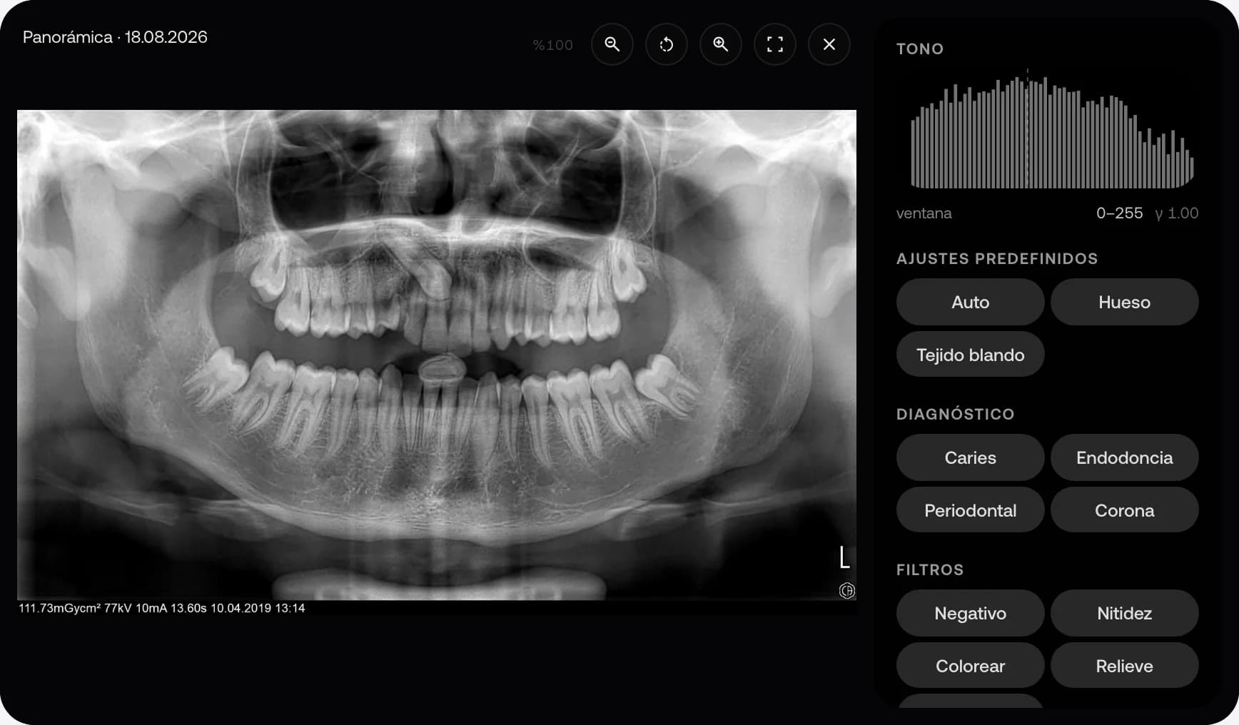 Radiografía panorámica dental de ejemplo en el visor de MyKlinik