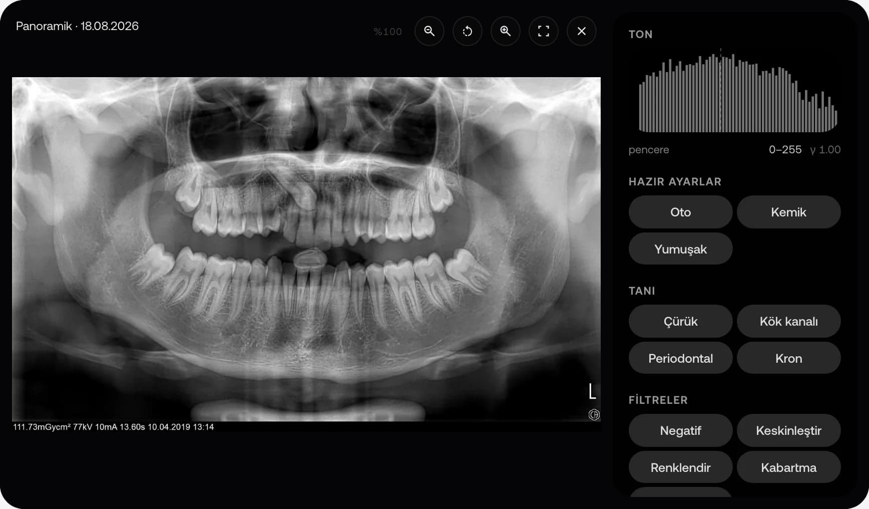 MyKlinik görüntüleyicisinde örnek panoramik diş görüntüsü