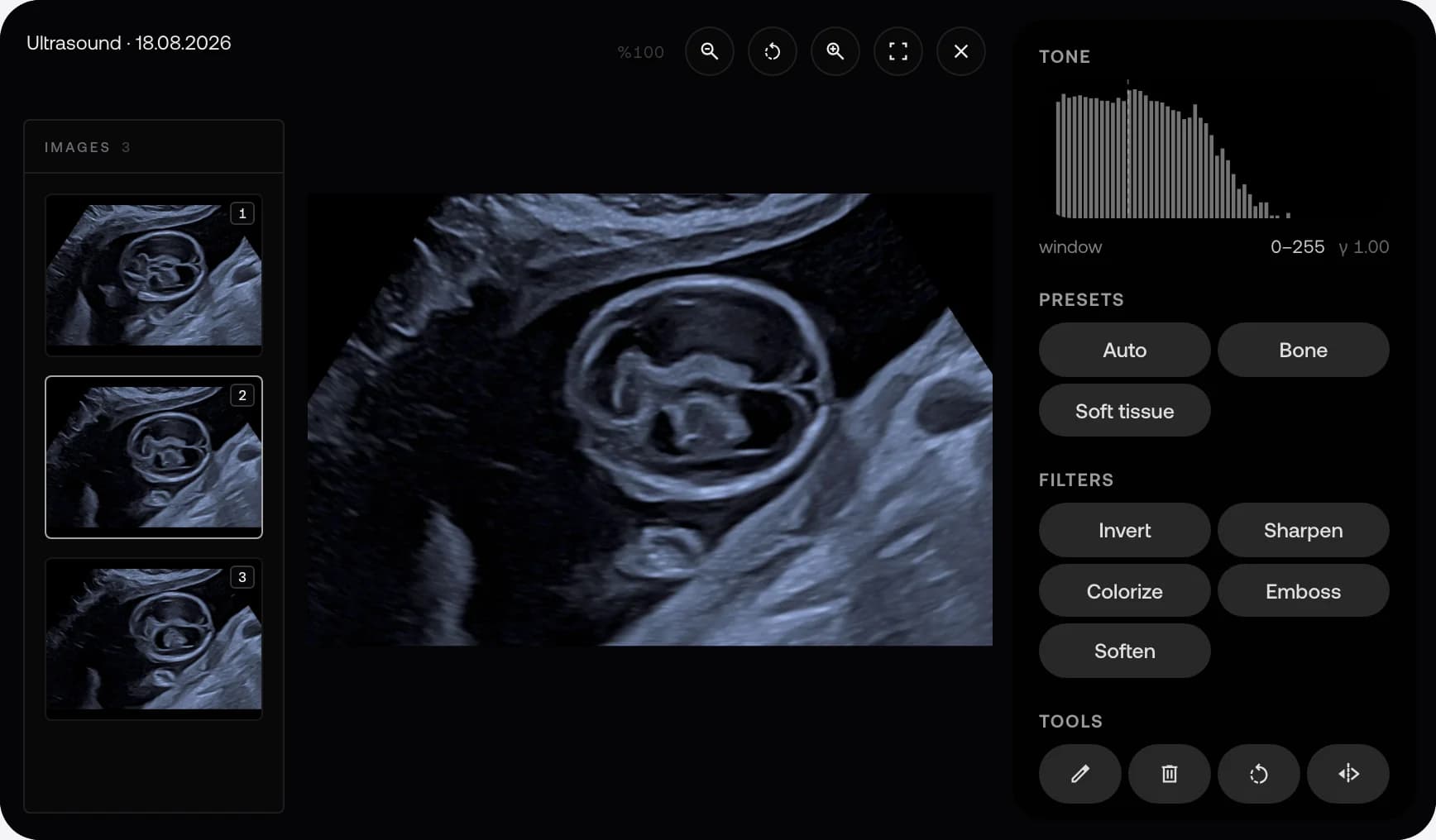 A sample fetal ultrasound in the MyKlinik viewer