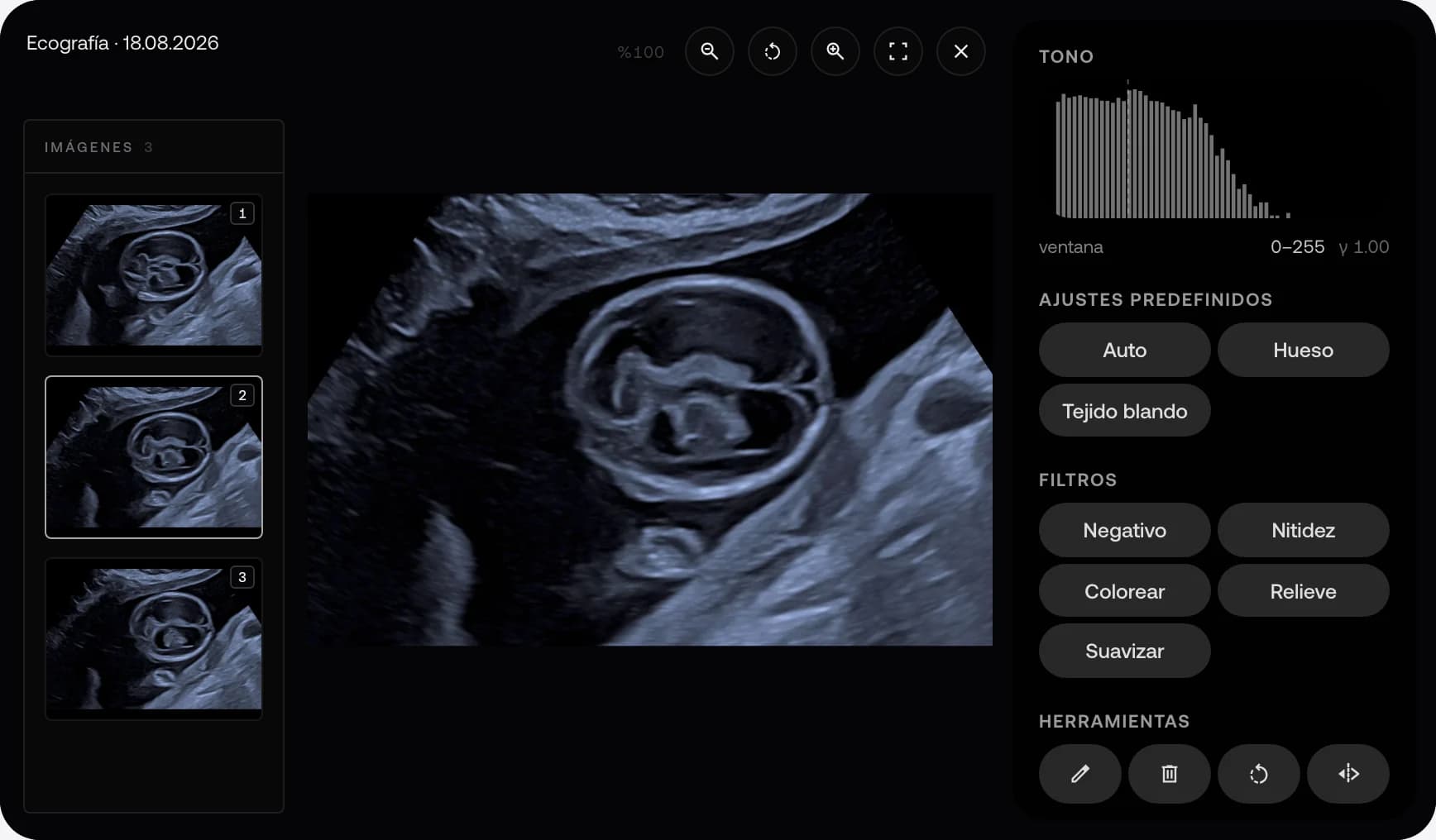 Ecografía fetal de ejemplo en el visor de MyKlinik