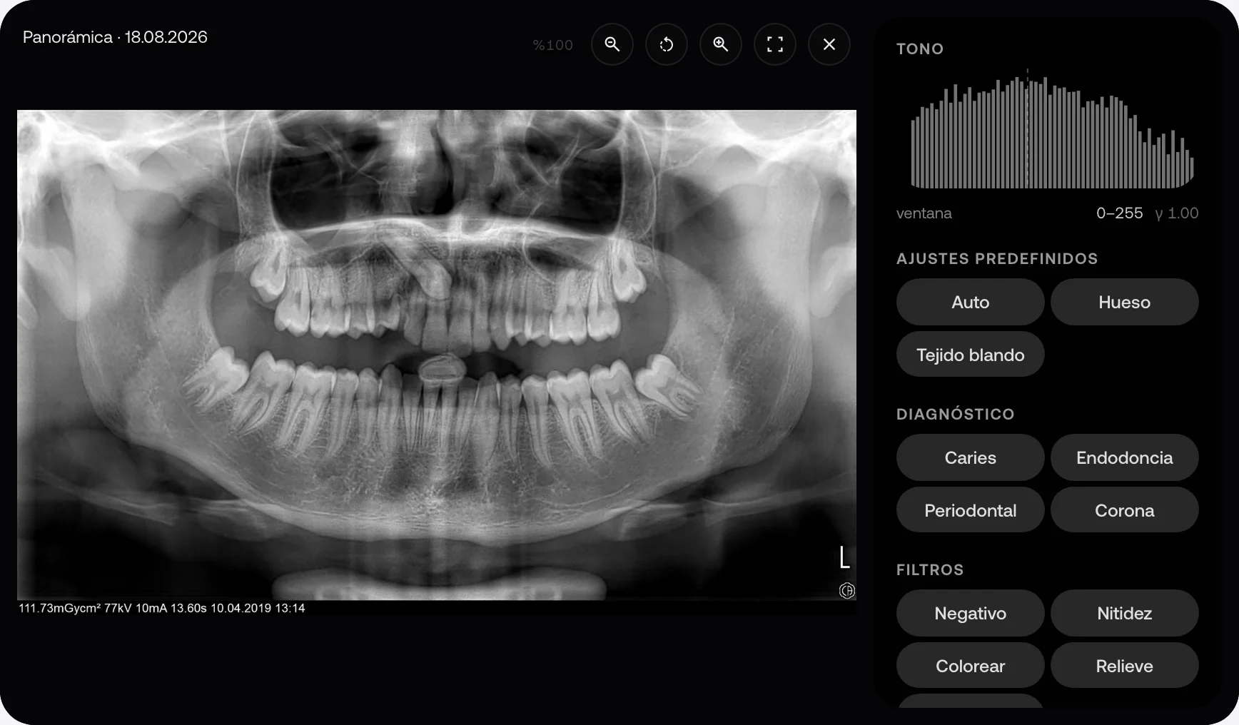 Radiografía panorámica dental de ejemplo en el visor de MyKlinik