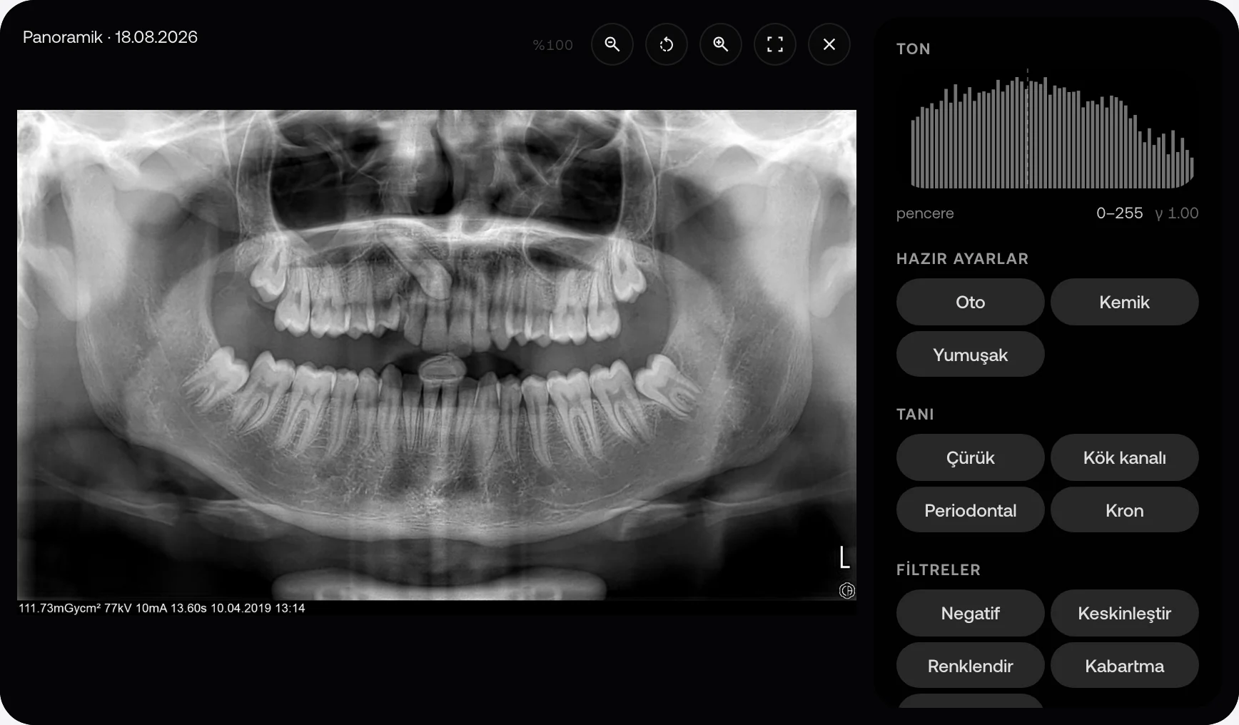 MyKlinik görüntüleyicisinde örnek panoramik diş görüntüsü