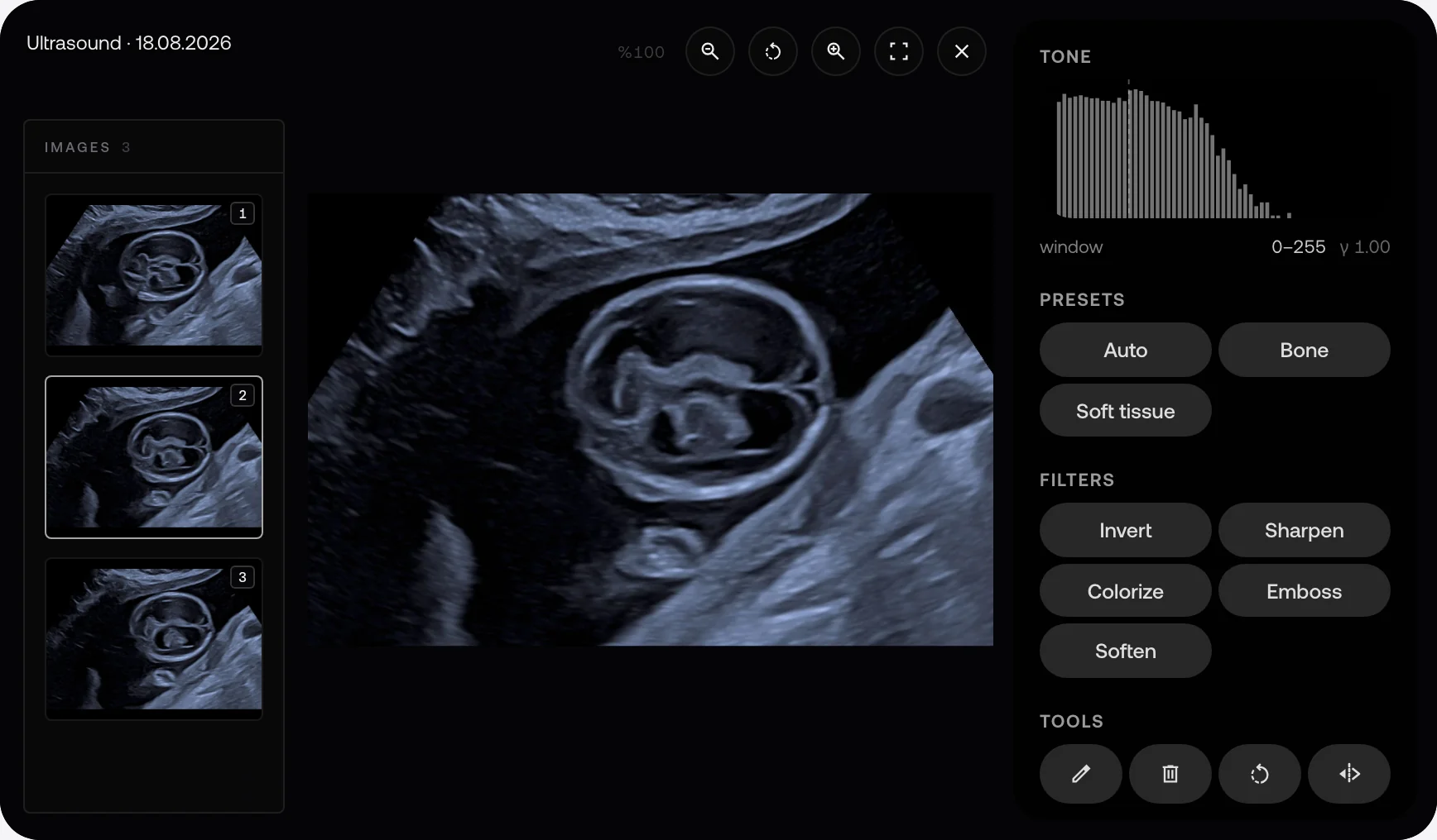 A sample fetal ultrasound in the MyKlinik viewer