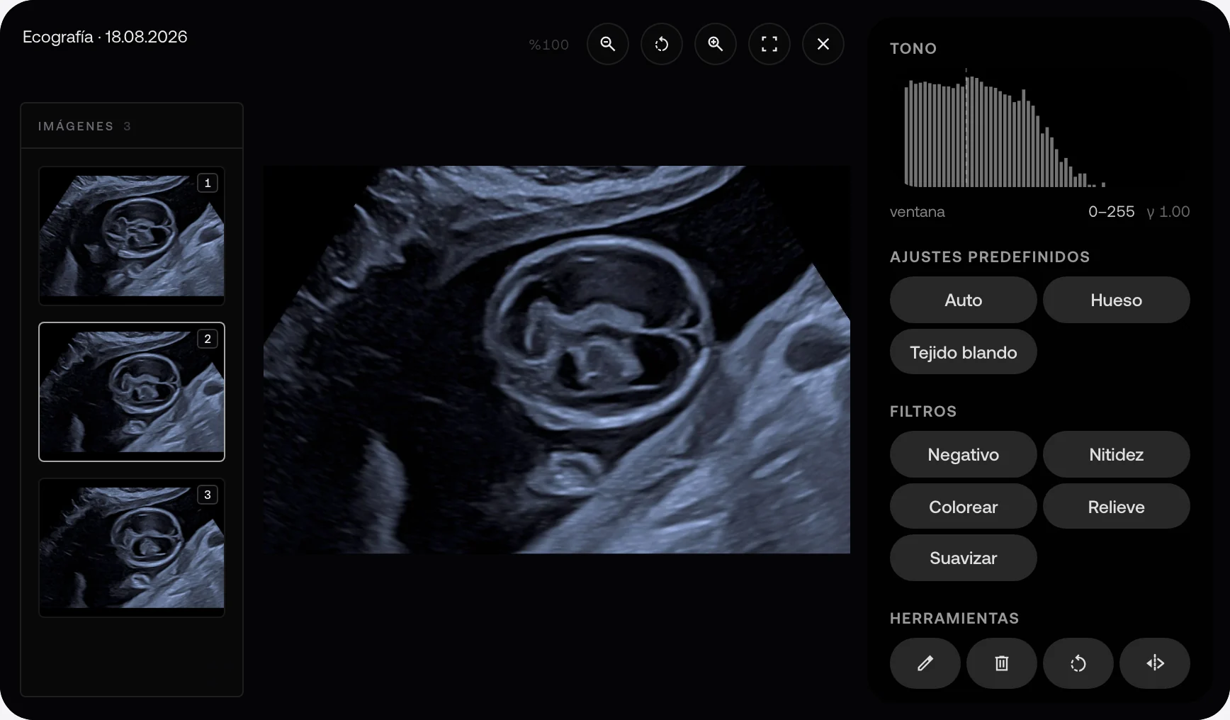 Ecografía fetal de ejemplo en el visor de MyKlinik